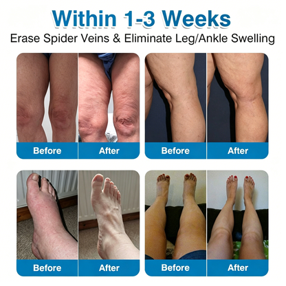 🥇👨‍⚕️✨VeinRepair Microneedle Patch Roll⚡Instant Relief, Long-Term Results